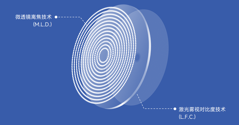 近视防控新选择:镜小昔Ultra双效合一,开启护眼新时代 近视防控新选择:镜小昔Ultra双效合一,开启护眼新时代